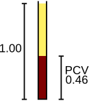 Schema van de handmatige hematocriettest met de fractie rode bloedcellen gemeten als 0,46.