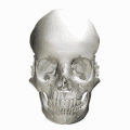 Human skull seen from side (parietal bones and temporal bones have been removed). Sella turcica shown in red.