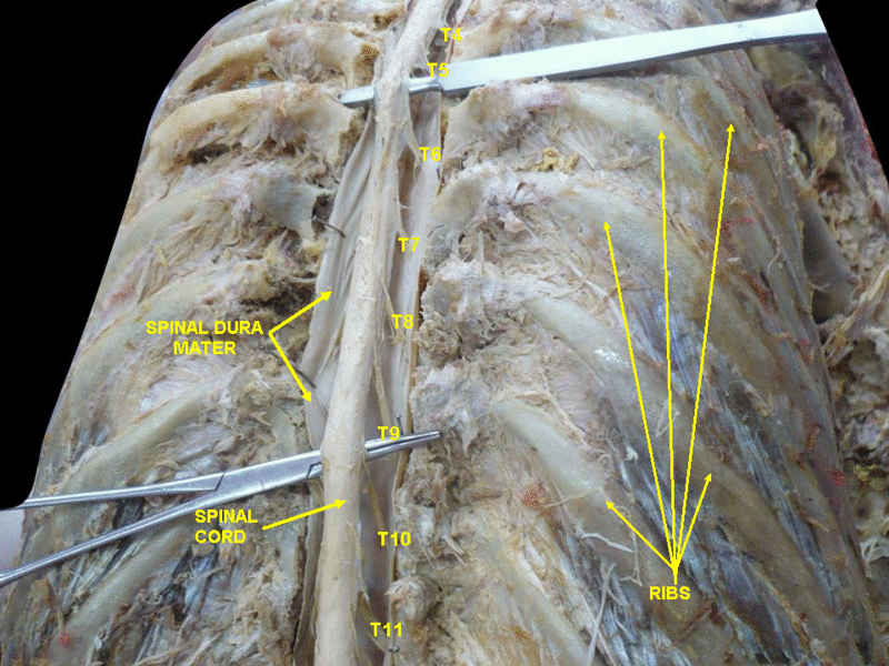 File:Slide2drdr.GIF