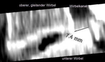 Datei:Wirbelgleiten.jpg