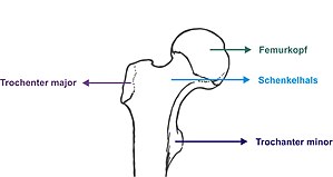 Schenkelhals und Hüftkopf