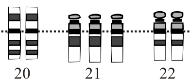 File:Down Syndrome Karyotype.20-22.png