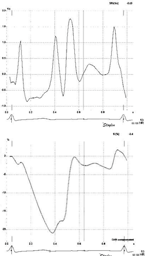 Strain rate imaging - Wikipedia