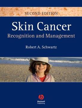 <i>Skin Cancer: Recognition and Management</i> Skin cancer