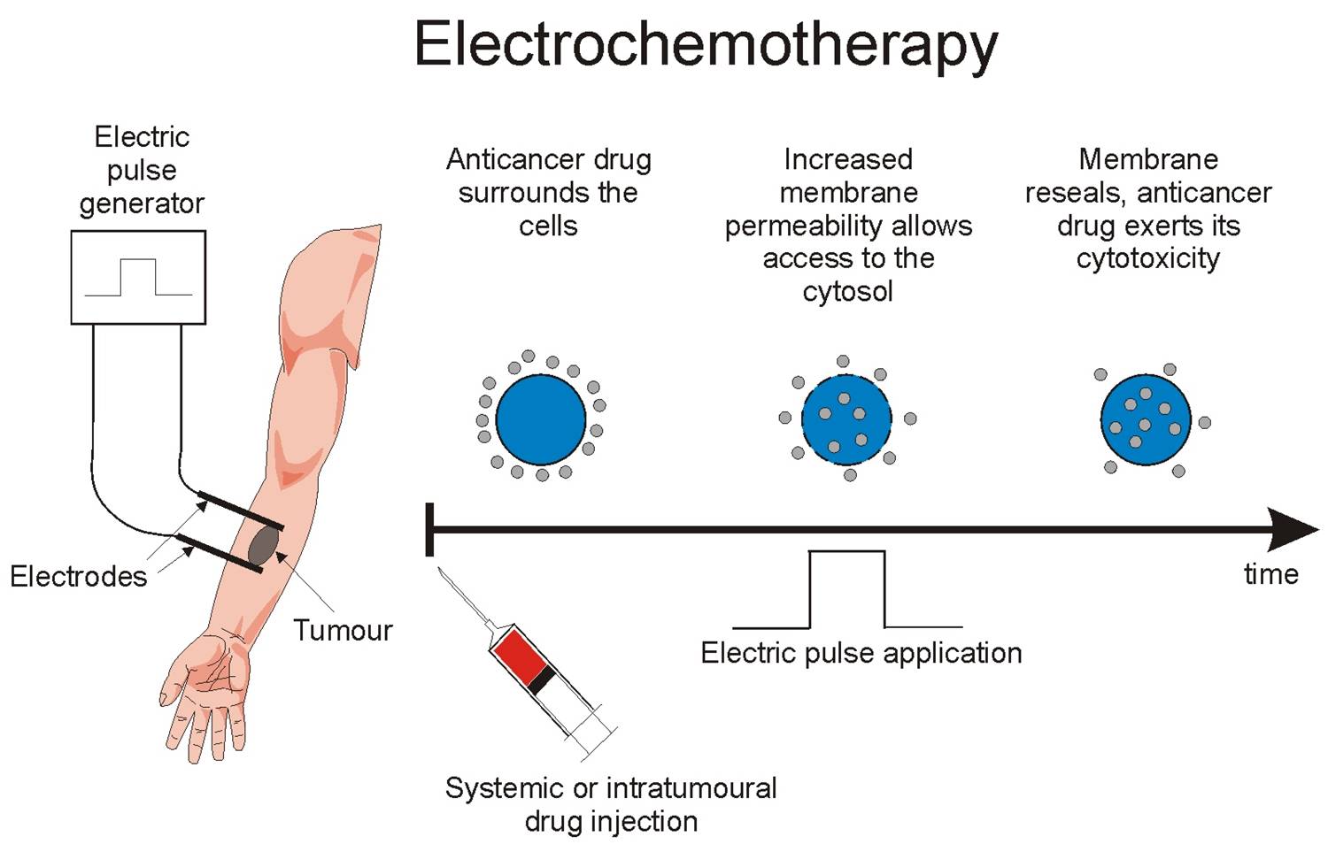 Electroconvulsive therapy - Wikipedia