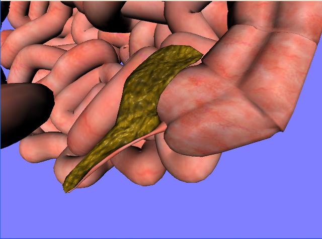 File:DH vermiform appendix.jpg