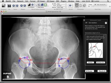 Dicom image viewer for mac