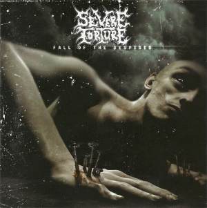 <i>Fall of the Despised</i> 2005 studio album by Severe Torture