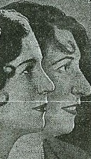 File:Singer.Lisa.Roma.profiles.before.and.after.rhinoplasty.1930.jpg