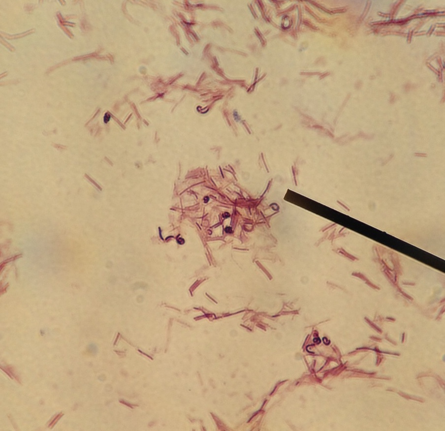 Лактобациллы фото под микроскопом