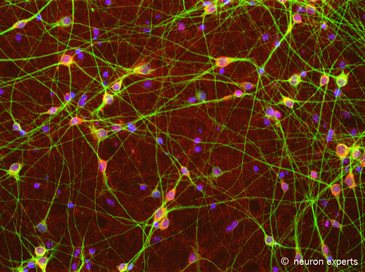 File:Gabaergic Neurons.png