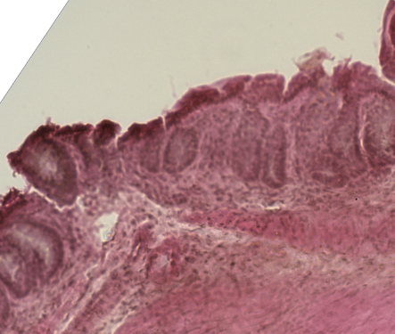 File:Mouse colon histology of acute graft versus host disease.png