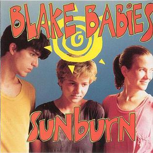 File:Sunburn Blake Babies.jpg