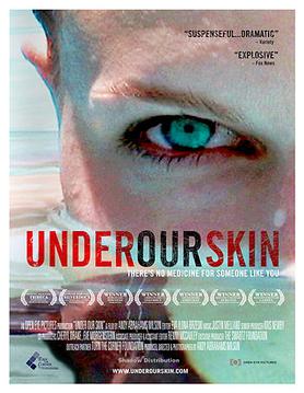 <i>Under Our Skin</i> 2008 film about chronic Lyme disease