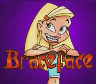 braceface