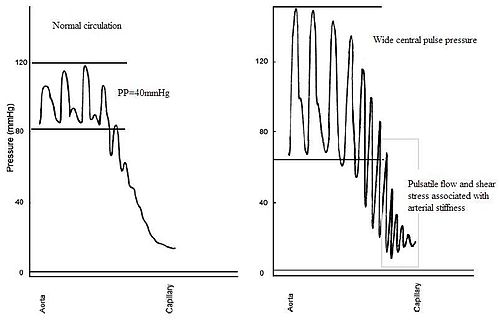 Pulsatile flow.jpg