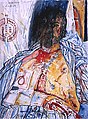 John Bellany Self-Portrait from 'The Addenbrookes Hospital Series', 1988, one of a series of self-portraits made after he had a liver transplant, covering his time in hospital.