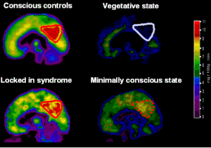 Neurowiki 1.GIF 