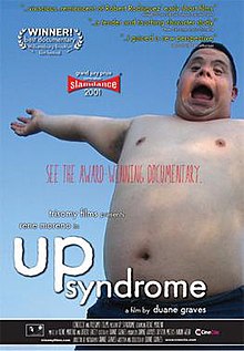 Up Syndrome poster.jpg