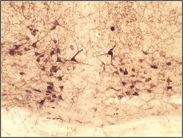 Relaxin-3 neurons in the mouse nucleus incertus Relaxin3 in the NI.jpg