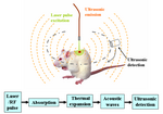 Thumbnail for Deep learning in photoacoustic imaging