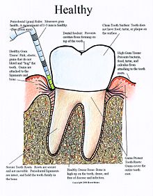 Periodontal Health, illustrated by Brent Molen, RDH Periodontal Health - Color.jpg