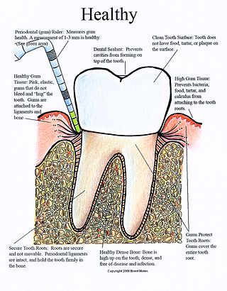 <span class="mw-page-title-main">Periodontal charting</span>