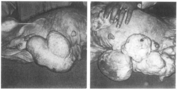 Mammary tumors in beagle dogs treated by (left) MK-665 (ethynerone with mestranol) and (right) chloroethynylnorgestrel with mestranol for 4 years at a dosage of 1.05 mg/kg/day cyclically. Progestin-induced tumors in beagle dogs.png