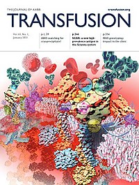 Transfusion Vol 61 Issue 1 cover.jpg