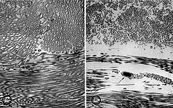 Transmission electron micrographs of sections of the Bermuda Blob (left) and St. Augustine carcass. Octopus giganteus TEM.jpg