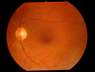 <span class="mw-page-title-main">Teleophthalmology</span>