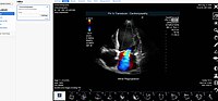 Thumbnail for Medical image sharing