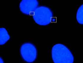 Micronuclei visible in boxes Micro 2.png