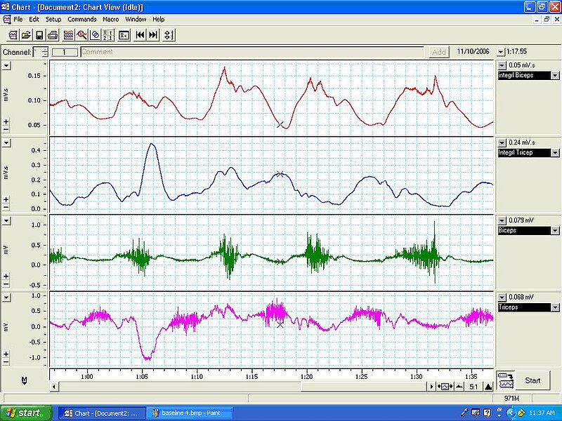 File:EMGCOACTIVATION.JPG