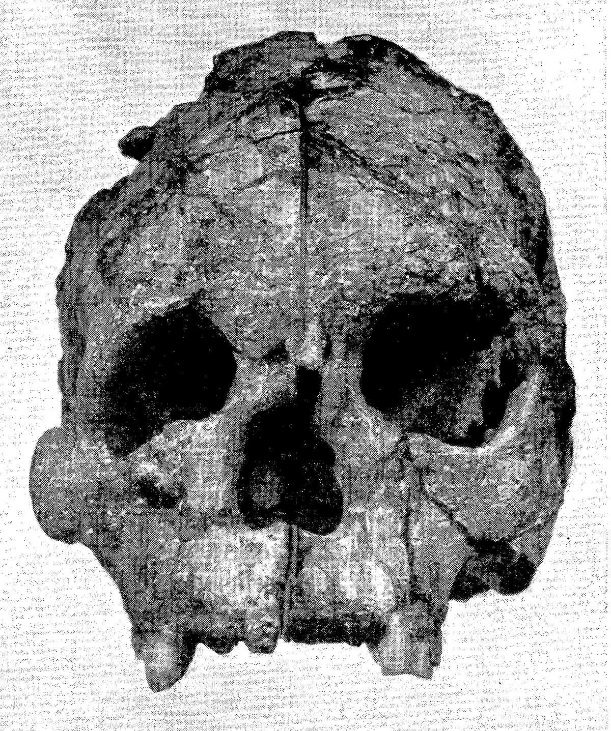 Talgai Skull - Wikipedia