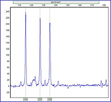 Example of Trisomy 21 detected via quantitative PCR short tandem repeat assay Trisomy Detection in GeneMarker.jpg