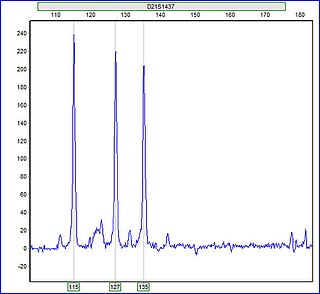 <span class="mw-page-title-main">Trisomy</span> Abnormal presence of three copies of a particular chromosome