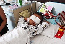 Six-year-old Guo Bin, who had his eyeballs removed due to organ trafficking Organ Trafficking of Corneas in China.jpeg