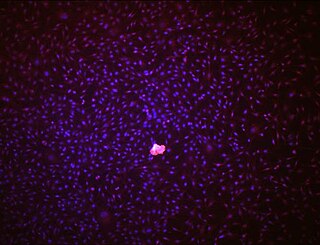 Endothelial stem cell Stem cell in bone marrow that gives rise to endothelial cells