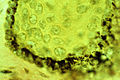 Melanin granules in the basal epithelium under light microscope