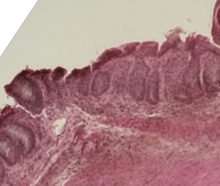 Mouse colon histology of acute graft versus host disease.png