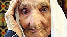 Fotografie starší ženy bledé pleti s bílou pokrývkou hlavy.