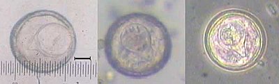 Eggs from proglottids of Bertiella studeri, seen under the microscope (scale bar = 10 mm) Eggs of tapeworm Bertiella studeri.jpg
