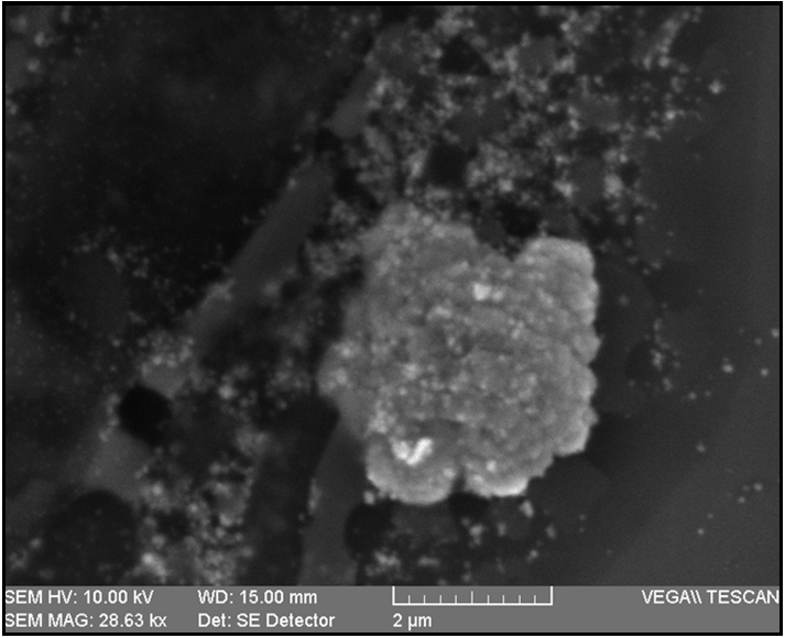 File:Fungal nanoparticles -conglomerate with smaller nanoparticles.tif