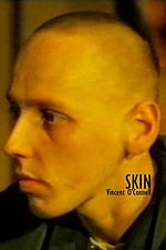 תמונה ממוזערת עבור Skin (סרט קצר, 1995)