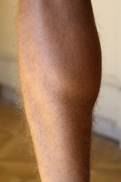 קובץ:Gastrocnemius.jpg