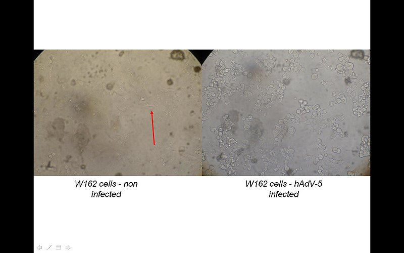 קובץ:Cytopathic effect.JPG