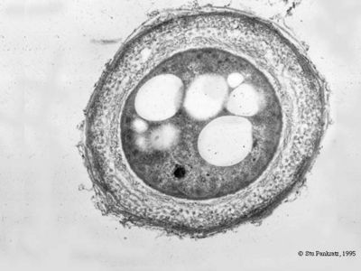 Файл:Azotobacter cyst.jpg