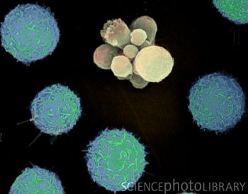Апоптоз человеческого лейкоцита. Микрофотография, сделанная с помощью сканирующего электронного микроскопа.