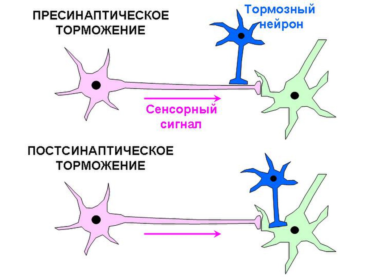 Механизм развития торможения. Схема пресинаптического и постсинаптического торможения. Постсинаптическое торможение схема. Первичное постсинаптическое торможение схема. Схема пре и постсинаптического торможения.